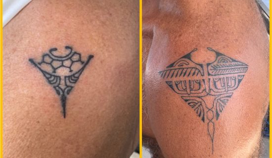 Tatoos